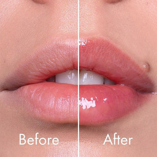 REEDLE SHOT LIP PLUMPER BEGINNER - Balsam De Buze Cu Efect De Voluminizare - skinseen.ro