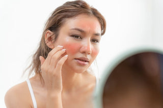 Piele reactiva, iritata: ingrediente si obiceiuri de evitat - skinseen.ro