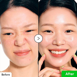 ALOE PDRN CALMING SERUM - Ser Pentru Calmare Si Regenerare - skinseen.ro